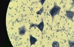 Neurons with processes under a microscope. Nervous tissue micropreparation