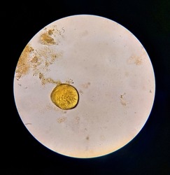 Urbanorium parasite analyzed under a microscope