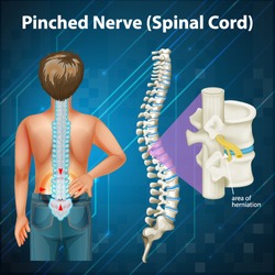 Diagram showing spinal cord illustration