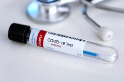 Testing for presence of coronavirus. Tube containing a swab sample for COVID-19 that has tested positive.