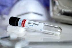 Negative results. Testing for presence of coronavirus. Tube containing a swab sample for COVID-19 that has tested NEGATIVE.