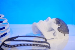 Medicine continue to make significant advancements in the field of bone skull head prosthetics