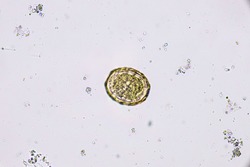 Ascaris lumbricoides (Fertilized egg)
Parasite ground worm