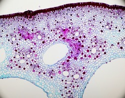 Spongy Tissue under microscope bright field magnification 100