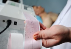 Electrocardiogram, ecg in hand. Clinic cardiology heart rhythm and pulse test closeup. Cardiogram printout.