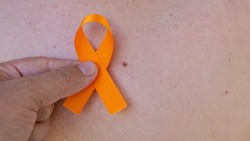 holding an orange tape over the skin with spots. campaign to prevent skin cancer, melanoma, December orange