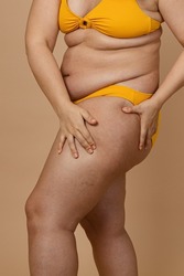Cropped photo of woman body excess orange skin in yellow underwear, treatment of obesity cellulite on hips, buttocks. Overweight fat folds hanging. Big size. Holding flabs. Imperfection puffy body. 