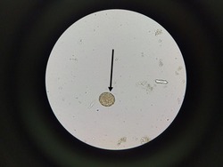 Eggs of Ascaris lumbricoides (roundworm) in stool, analyze by microscope