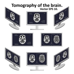 Set of cross section of the brain during magnetic resonance imaging on a computer screen in isometric view. A few pictures of the image of the brain. MRI / CT scan. Vector EPS10.
