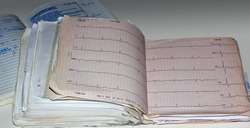 cardiogram of the heart on paper 