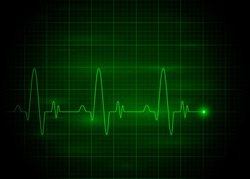 Heart pulse graphic. Vector illustration, eps 10.