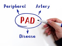  PAD Peripheral Artery Disease on Concept photo. Fashion and modern office interiors on an background.