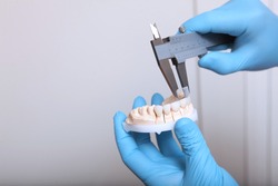 A dental technician makes the measurement of the veneers. Ceramic and composite veneers. Hands in protective gloves. The concept of beauty and health. Unrecognizable person. Copy space.