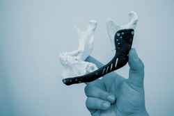 Person holding in hand 3D printed plastic prototype human lower jaw and medical titanium implant close-up. Prosthesis anatomical bone 3D printed from metal powder. Orthopedic maxillo-facial prosthesis