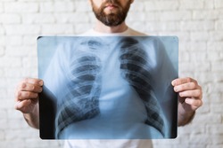 Young bearded man holding X-ray film of lungs and heart in front of his chest, white background