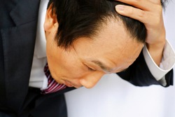 Forehead of a Japanese businessman. The hairline is receding. The image of baldness.