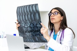A young dark-haired female doctor with glasses examines an MRI scan in a medical office.Medical concept.