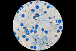 Characterization of aspergillus spp. under light microscope at 20x magnification after staining with Lactophenol cotton blue