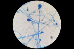 Characterization of Rhizopus spp. under light microscope at 100x magnification after staining with Lactophenol cotton blue