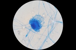 Characterization of Aspergillus terreus fungi under light microscope at 100x magnification after staining with Lactophenol cotton blue