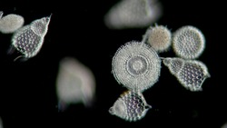 microscopy of a sampling of diatoms, microalgae, jewels of the sea, living opals