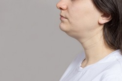 The woman has a double chin. Treatment, chin reshaping, fat removal, lifting. Place for text copy space