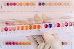 Biochemical test kit for microorganism identification 