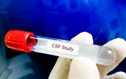 Cerebrospinal fluid (CSF) study including biochemistry, cytology, Gram staining.