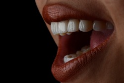 Beautiful woman lip with hollywood smile dental porcelain veneer treatment.