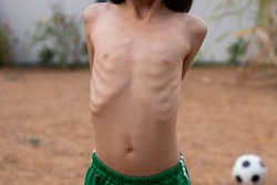 Half-body portrait of a skinny white boy stretching in the back yard before playing football placed behind Shows the ribs that line the body clear .even though  was thin, he was healthy by exercising.