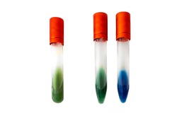 
Bacterial Biochemical Identification tests in tubes with slant medium. Microbiology examination isolated o white background.