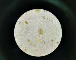 Stool examination under direct smear, then microscope performed 40x magnification And show the Ascaris lumbricoides fertilized egg.