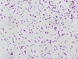 Bacteria Enterococcus isolated on white background micrograph. Gram-positive cocci which cause infant endocarditis and other infections