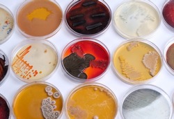 COLLECTION OF PETRI DISHES CONTAIN GROWTH OFBACTERIAL AND FUNGAL CELLS