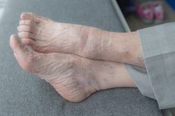 An old age lady showing her feet