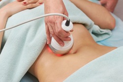 Radio frequency skin tightening, belly. Female body, cosmetology procedure.