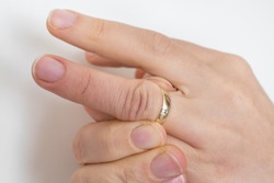 Woman cannot take off stuck wedding ring - fat fingers and big knuckles