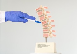 The doctor shows a model of the human spine, which shows various defects in the vertebrae. Inscriptions on the model: 1-Compression fracture, 2-Normal vertebral, 3-Osteoporotic bone, 4-Wedge fracture.