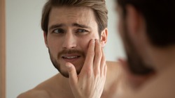 Close up head shot unhappy man looking in mirror, feeling stressed of sensitive skin or acne breakout, thinking of cosmetology treatment. Depressed young guy dissatisfied with skin condition.