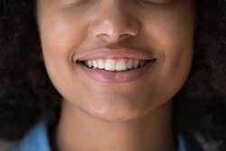 Cropped close up face view lower part of young beautiful African girl, smile reveal white teeth advertise dental clinic, having pure perfect facial skin, cleansing products, teen-age cream ad concept