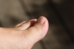 left toe of a Caucasian woman seen in profile with her left big toe and nail