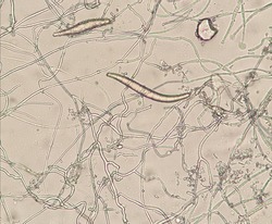 Microscopic morphology of Trichophyton mentagrophytes. Trichophyton mentagrophytes is superficial fungal infection of the skin and hair.