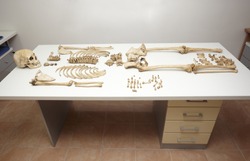 close up of a skeleton on white table in autopsy room