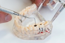 plastic model of a human jaw.  Dentist demonstrates problems with teeth. Oral dental hygiene concept. Dental dentistry students teaching model showing teeth, roots, gums, gum disease, caries 