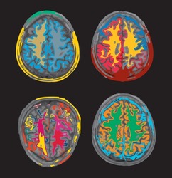 colorful MRI set of the brain of an adult male on a black background