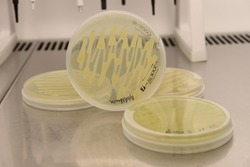 Inoculated microbial plates with bacteria in the microbial cabinet (laminar)