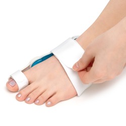 orthosis for bunions, hallux valgus on the woman's foot on the front. Chiropractic solution for problem with deformed toe