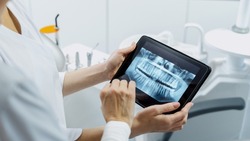 Cropped shot of professional dentist showing jaws and teeth x-rays to her patient, using a digital tablet technology, discussing a treatment plan while they standing in stomatology clinic, web banner