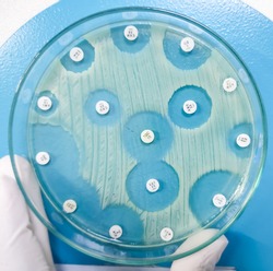 Antimicrobial susceptibility testing in culture plate. Drug sensitivity test, disk drug, antibiotic sensitivity.