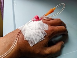 person's hand being given an IV, close-up